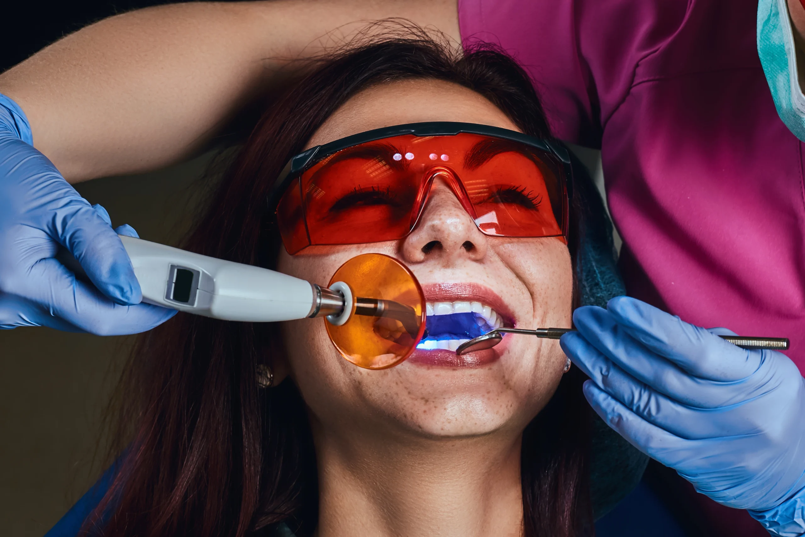 Teeth Whitening Myths You Should Stop Believing
