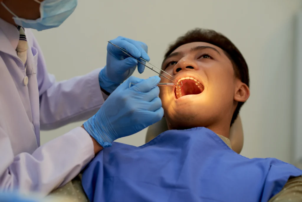 Everything You Need to Know About Wisdom Teeth Removal